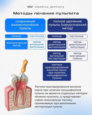 Пульпит: методы лечения из студенческой тетради.